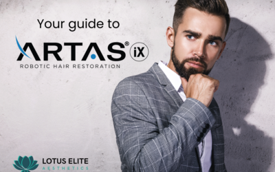 Your Guide To ARTAS™ iX Robotic Hair Restoration