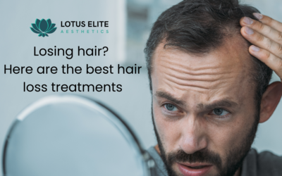 Losing hair? Here are the Best Hair Loss Treatments